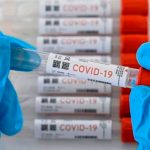 Prestigiosa revista destaca investigación del MINSA Nicaragua