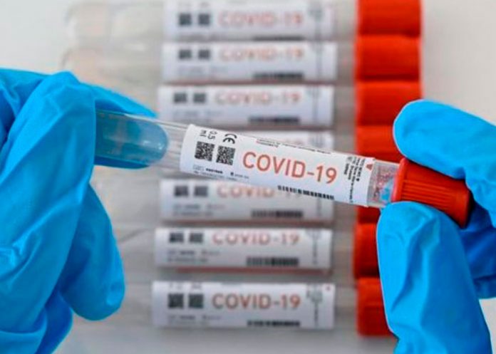 Prestigiosa revista destaca investigación del MINSA Nicaragua