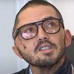 «Vive para contarlo»: Ciudadano sufre voraz mordida de cocodrilo en Florida (VIDEO) "Vive para contarlo": Ciudadano sufre voraz mordida de cocodrilo en Florida (VIDEO)