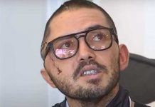 «Vive para contarlo»: Ciudadano sufre voraz mordida de cocodrilo en Florida (VIDEO) "Vive para contarlo": Ciudadano sufre voraz mordida de cocodrilo en Florida (VIDEO)