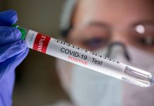 Desarrollan una prueba doméstica para predecir la inmunidad contra el COVID Científicos desarrollan una prueba doméstica para predecir la inmunidad COVID