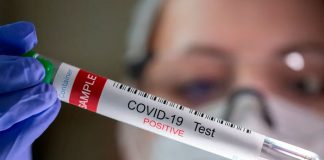 Científicos desarrollan una prueba doméstica para predecir la inmunidad COVID
