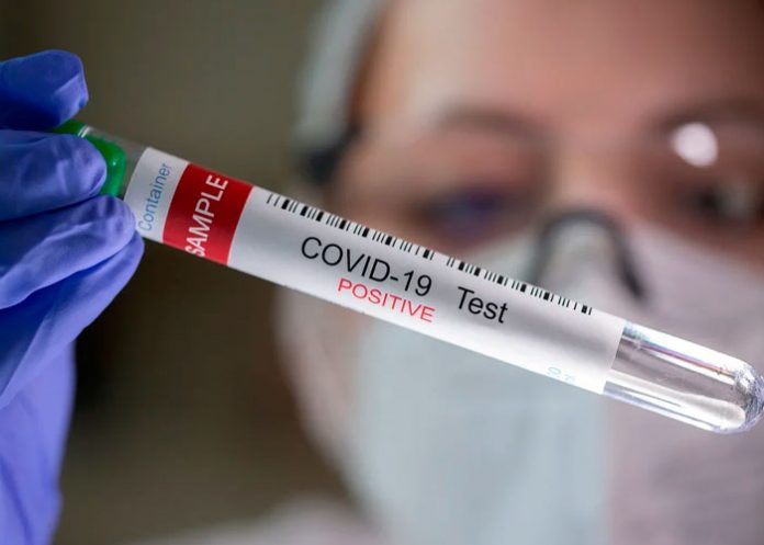 2 Científicos desarrollan una prueba doméstica para predecir la inmunidad COVID