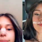 Joven perdona infidelidad de su pareja, pero lo obliga a pagarle una cirugía Joven perdona infidelidad de su pareja, pero lo obliga a pagarle una cirugía