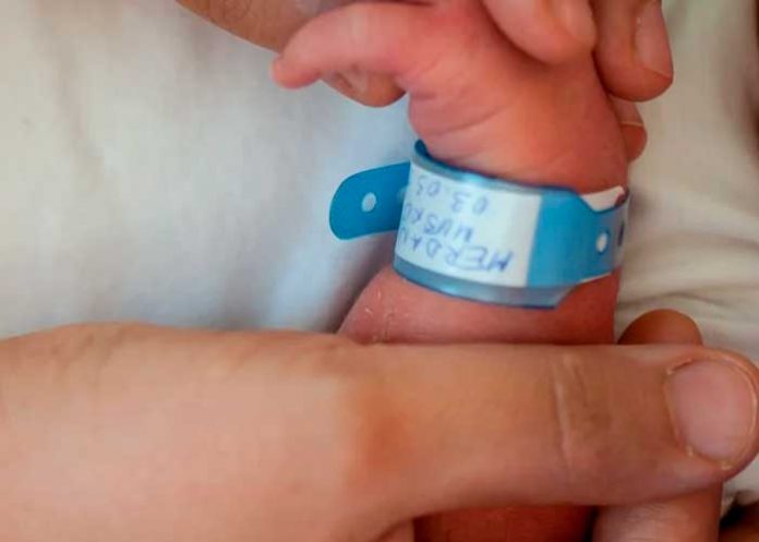 Insólito nacimiento de bebé con un cuerno en vez de piernas en la India