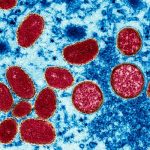 EE.UU. confirma estados como Illinois en alerta máxima