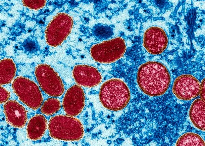 EE.UU. confirma estados como Illinois en alerta máxima