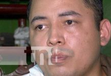 ¡Sobreviví!: La historia de Ricardo, quien sufrió atroz accidente en Managua El rostro de un sobreviviente de accidente en Managua