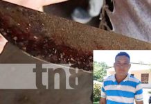 Violencia machista: Macheteó a su pareja en ataque de ira en Rivas Capturan a hombre en Rivas por femicidio frustrado