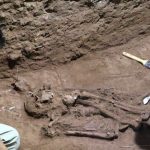 ¡Interesante! "La cirugía existe desde hace 31 mil años atrás"