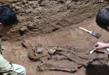 ¡Interesante! "La cirugía existe desde hace 31 mil años atrás"