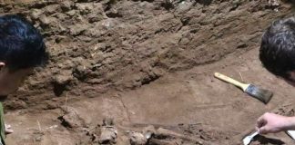 ¡Interesante! "La cirugía existe desde hace 31 mil años atrás"