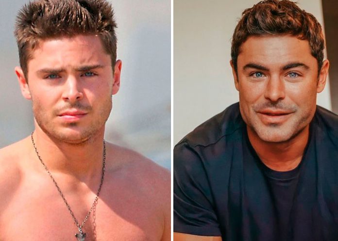 Zac Efron desata ola de criticas tras aparecer con el rostro 