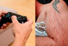 Joven es impactado por un rayo en su brazo mientras jugaba Playstation