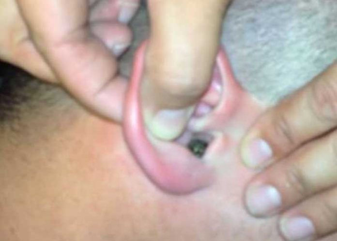 ¡Asqueroso! Joven tenía un 