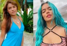 Esta es la única cirugía que posee Karol G desde los 18 años Esta es la única cirugía que posee Karol G desde los 18 años