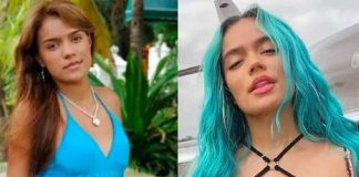 Esta es la única cirugía que posee Karol G desde los 18 años