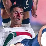 ¡Bañado en sangre! Cristiano Ronaldo recibe fuerte golpe ¡Bañado en sangre! Cristiano Ronaldo queda tendido en el campo