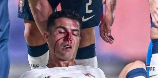¡Bañado en sangre! Cristiano Ronaldo queda tendido en el campo