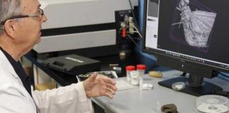¡De 35 millones de años! Encuentran raro insecto atrapado en ámbar