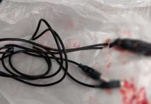 "Por vago se va quedar sin amiguito": Joven mete cable USB por su uretra