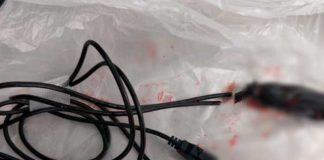 "Por vago se va quedar sin amiguito": Joven mete cable USB por su uretra