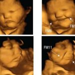 Fotos de fetos que reacciona según lo que coma mamá