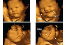 ¡Uyy que tierno! Reacción de los fetos según lo que coma su «mamita» Fotos de fetos que reacciona según lo que coma mamá