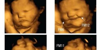 Fotos de fetos que reacciona según lo que coma mamá