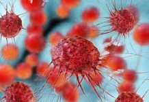Novedoso estudio abre «nueva era» en la detección temprana del cáncer El propósito de la detección del cáncer