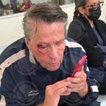 Por buen samaritano: Le dan tremendos golpes a Alfredo Adame Alfredo Adame es golpeado afuera de su domicilio