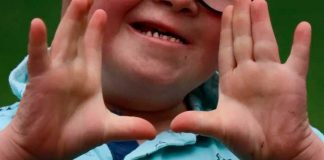 Niño con síndrome de Down víctima de aberrante abuso sexual en Colombia