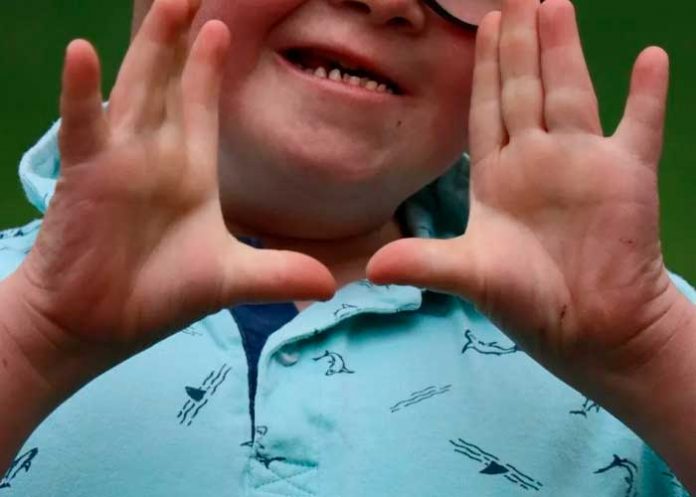 colombia4 Niño con síndrome de Down víctima de aberrante abuso sexual en Colombia