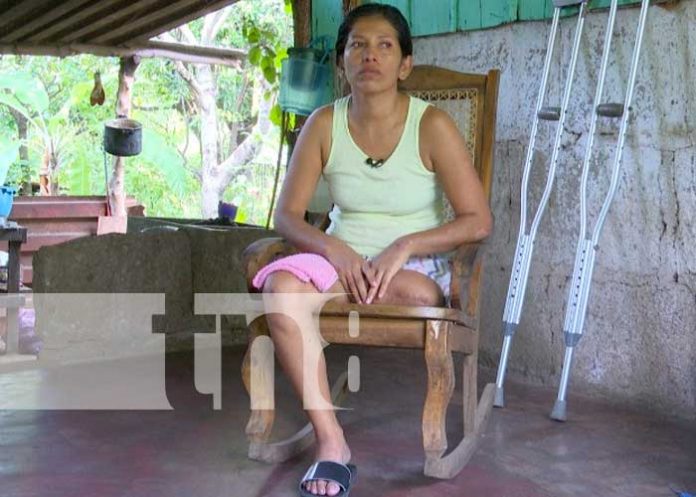 Elizabeth, amputada tras accidente, pero con muchas ganas de salir adelante