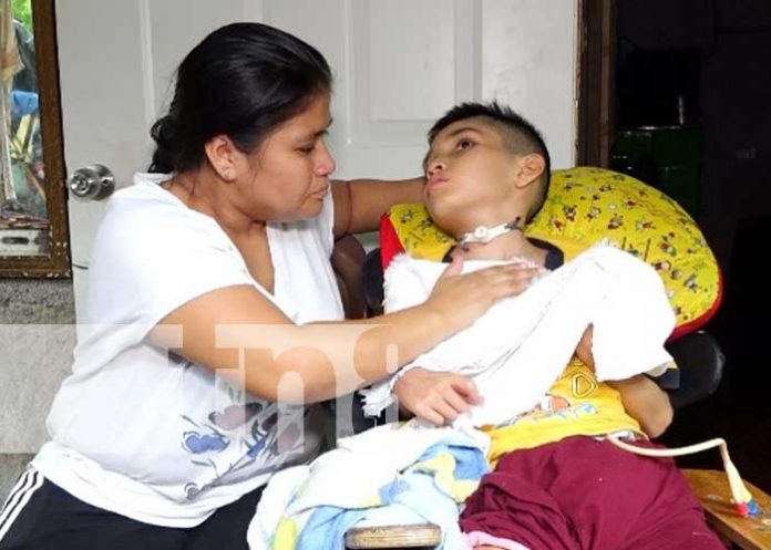 jorge-03 Jorgito, niño que necesita de ayuda tras sufrir accidente