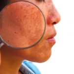 ¿Te importa aclarar la piel? Este es el truco para lucir más joven Uno de los aliados para aclarar la piel es la vitamina B3