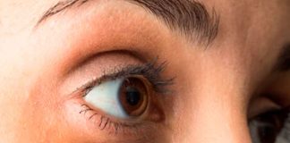 Mitos y verdades médicas detrás de las ojeras