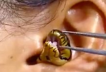 La víbora viva se resistía a salir de la oreja de una chica