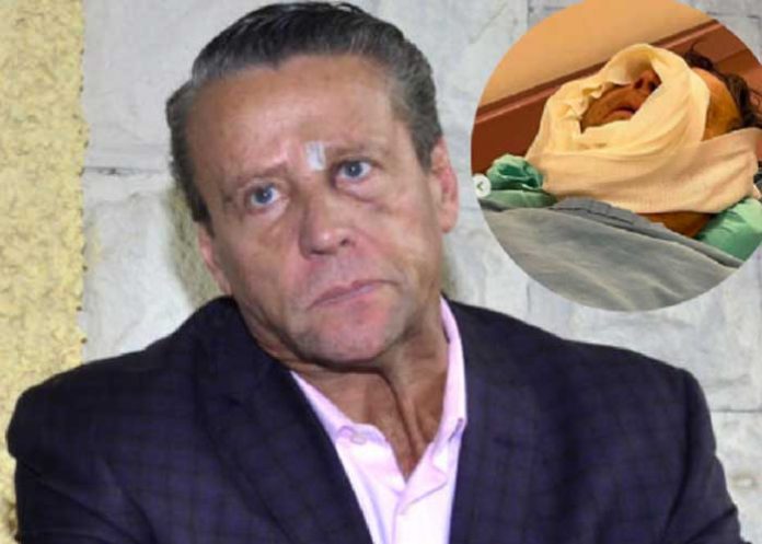 1 Alfredo Adame revela fotos de la cirugía de emergencia que recibió