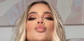 Khloé Kardashian y la anomalía con la que vivió en su rostro