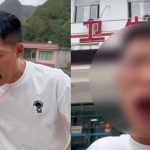 «Por ganar seguidores» Se come una avispa viva y se le deformó la cara "Por andar de chistoso" Se come una vispa viva y se le deformó la cara