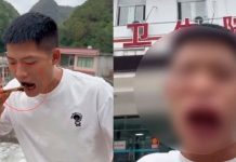 "Por andar de chistoso" Se come una vispa viva y se le deformó la cara