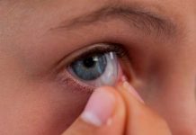 Tengan cuidado: Mujer acumuló 23 lentes de contacto en los ojos Tengan cuidado: Mujer acumuló 23 lentes de contacto en el ojo