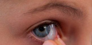 Tengan cuidado: Mujer acumuló 23 lentes de contacto en el ojo