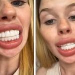 Mujer se arrepiente de su cirugía: "Me veo como un caballo"