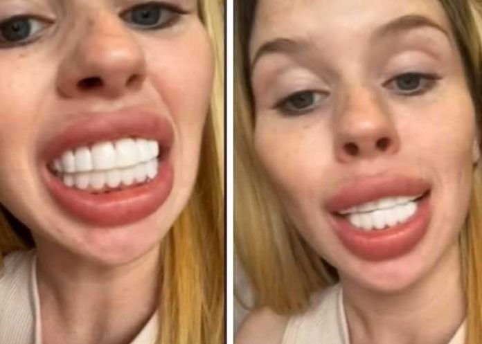 1 Mujer se arrepiente de su cirugía: