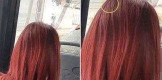 Mujer es grabada con un "piojo" en la cabeza y la difunden en redes