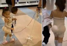 Niña causa indignación en redes con su traje de «operada» NIña causa indignación en redes con su traje de "operada"