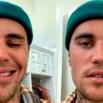 Justin Bieber cancela 28 conciertos por el avance del Síndrome que padece Justin Bieber cancela 28 conciertos por el avance del Síndrome que padece