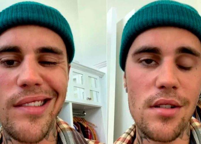 Justin Bieber cancela 28 conciertos por el avance del Síndrome que padece